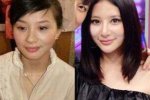 熊乃瑾整容前后照片對(duì)比 熊乃瑾自己也承認(rèn)整容
