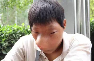 河南大學(xué)生患怪病