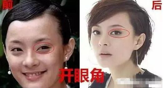 孫儷自曝整過(guò)容