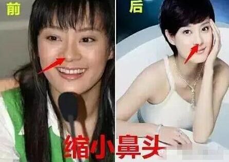 孫儷自曝整過(guò)容