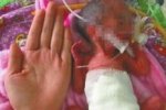成都女嬰僅巴掌大 早產(chǎn)女嬰生命體征穩(wěn)定